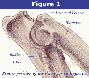 Elbow Fig 1